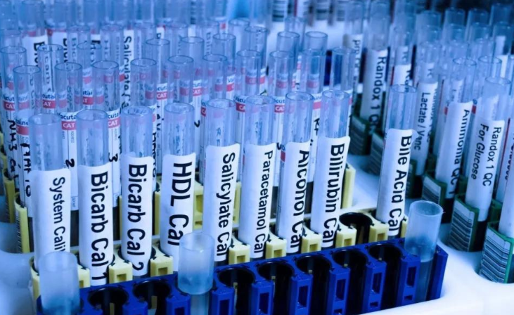 平行樣品一般為三,平行試驗也為三